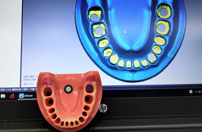 3D scanning applications for medical purposes