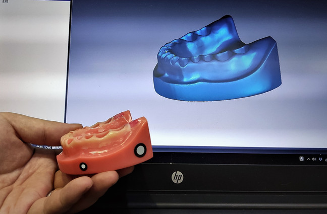 3D Scanning for intraoral dental prosthesis design